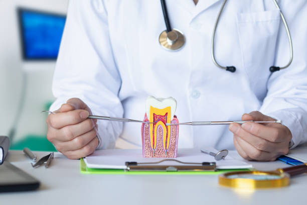 Best Knocked-Out Tooth (Avulsed Tooth) Treatment in Staic, CA